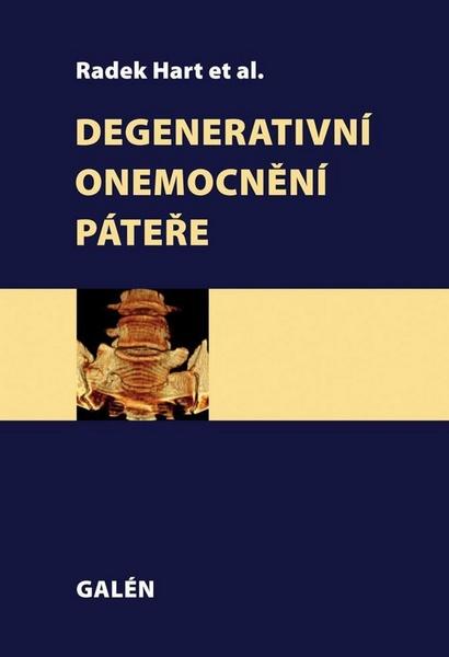 Degenerativní onemocnění páteře - Radek Hart, kol.