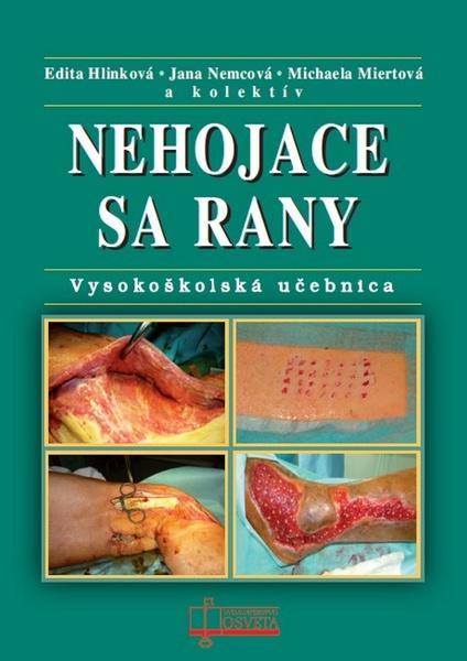 Nehojace sa rany - 978-80-8063-433-9