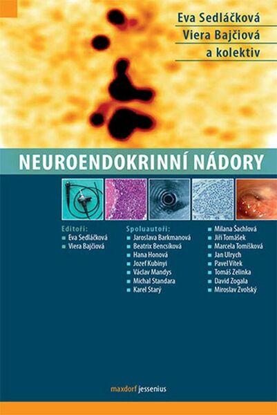 Neuroendokrinní nádory - 978-80-7345-468-5