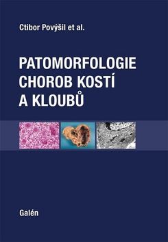 Patomorfologie chorob kostí a kloubů - 978-80-7492-308-1