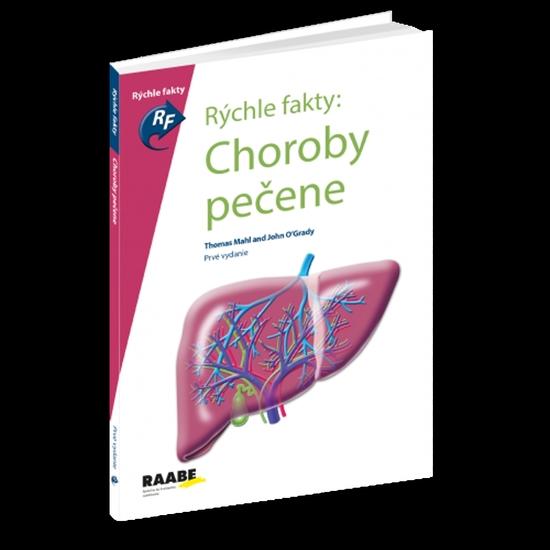 Rýchle fakty: Choroby pečene - 978-80-8140-360-6