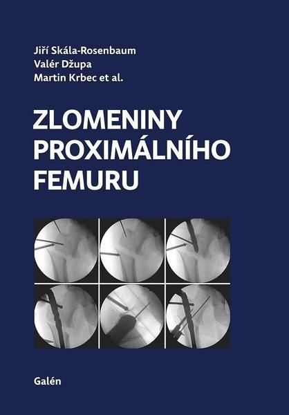 Zlomeniny proximálního femuru - Kolektiv - 978-80-7492-423-1