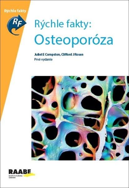 Osteoporóza - Juliet Compston, Clifford E. Rosen - 978-80-8140-372-9