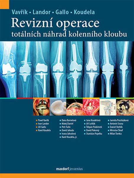 Revizní operace totálních náhrad kolenního kloubu - 978-80-7345-602-3