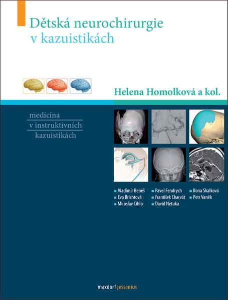 Dětská neurochirurgie v kazuistikách - 978-80-7345-577-4