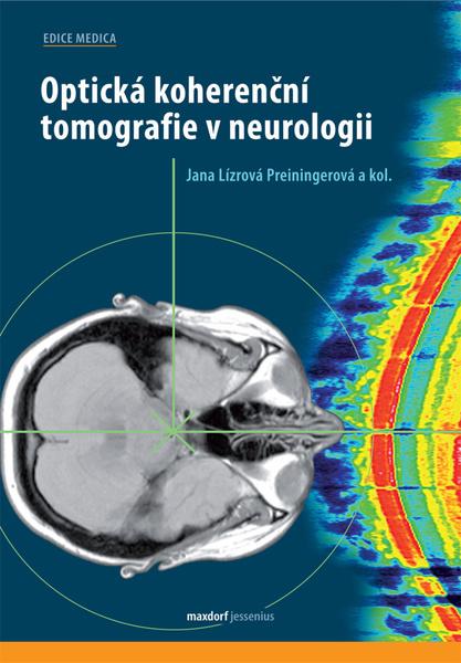 Optická koherenční tomografie v neurologii - 978-80-7345-661-0