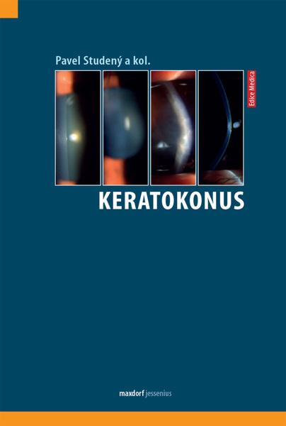 Keratokonus - 978-80-7345-665-8