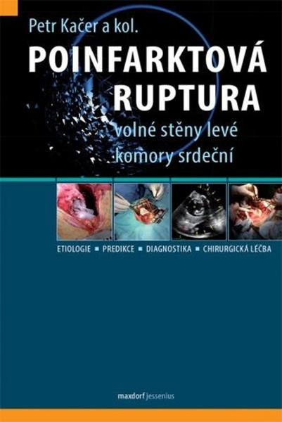 Poinfarktová ruptura - 978-80-7345-646-7