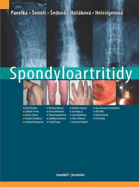 Spondyloartritidy - Karel Pavelka; Ladislav Šenolt; Liliana Šedová - 978-80-7345-679-5