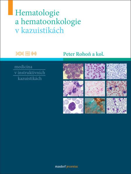 Hematologie a hematoonkologie v kazuistikách - 978-80-7345-681-8