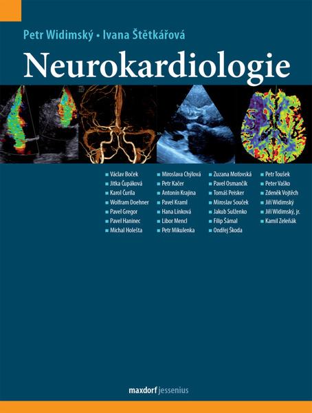Neurokardiologie - 978-80-7345-644-3