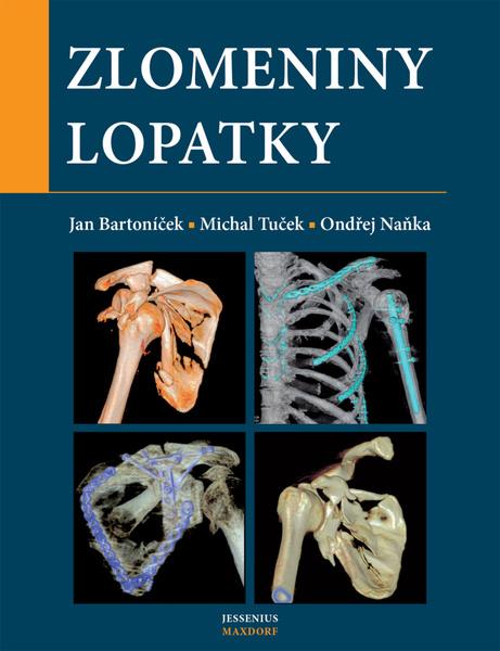 Zlomeniny lopatky - 978-80-7345-690-0