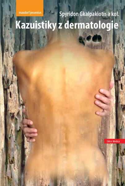 Kazuistiky z dermatologie - 978-80-7345-700-6