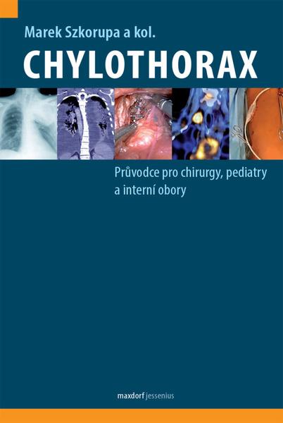 Chylothorax - 9788073457174