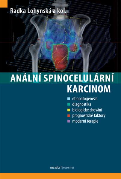 Anální spinocelulární karcinom - 9788073457150
