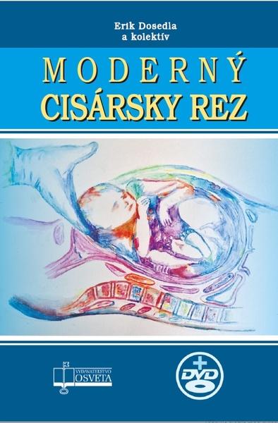 Moderný cisársky rez - 9788080635077