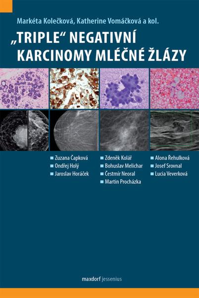 „Triple“ negativní karcinomy mléčné žlázy - 9788073457235