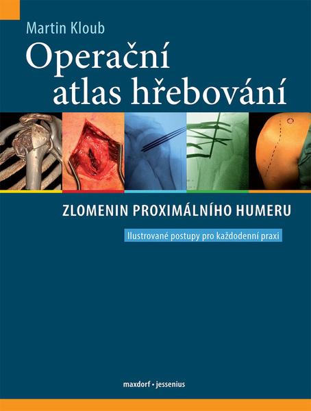 Operační atlas hřebování zlomenin proximálního humeru - 9788073457228