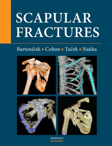 Scapular fractures - 9788073457310