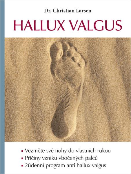 Hallux valgus - Christian Larsen