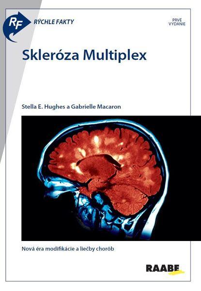 Skleróza Multiplex - 9788081408014