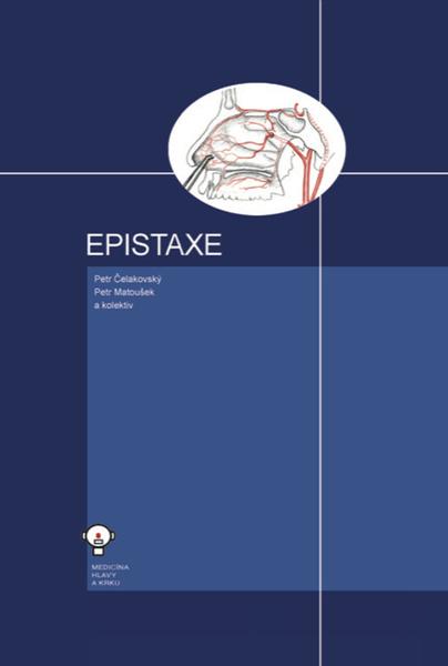 Epistaxe - 9788073112127