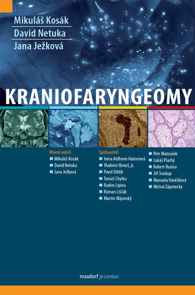 Kraniofaryngeomy - 9788073457839
