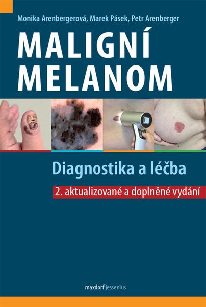 Maligní melanom - 9788073457969