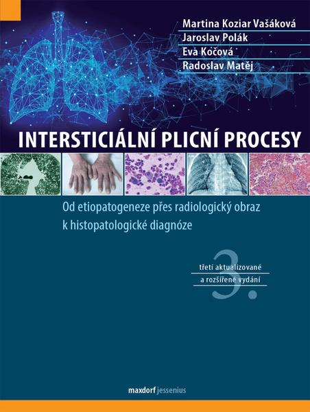 Intersticiální plicní procesy - kol.