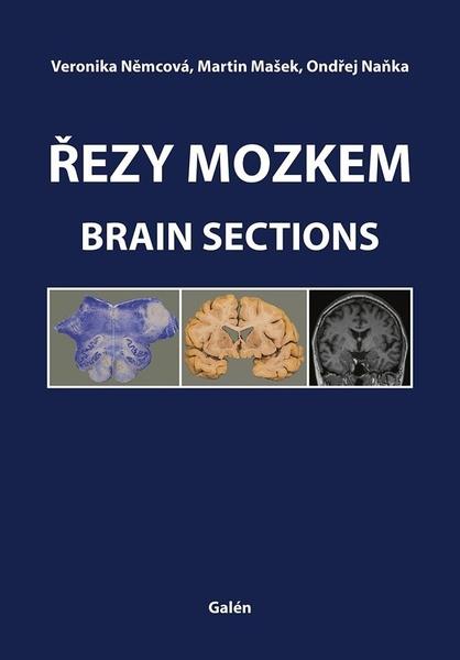 Řezy mozkem - 9788074927539