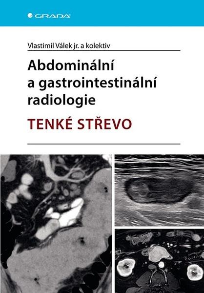 Abdominální a gastrointestinální radiolologie - 9788027158638