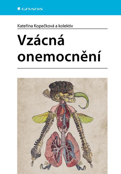 Vzácná onemocnění - 9788027154692